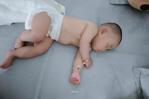 长沙宝宝头上长痱子